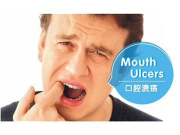 留學(xué)生在英國得了口腔潰瘍怎么辦？--優(yōu)越教育